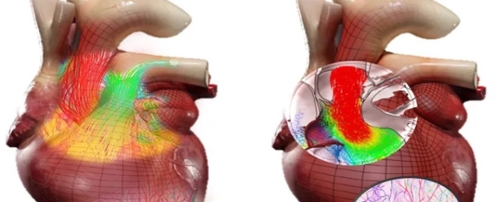 heart-with-aortic-flow