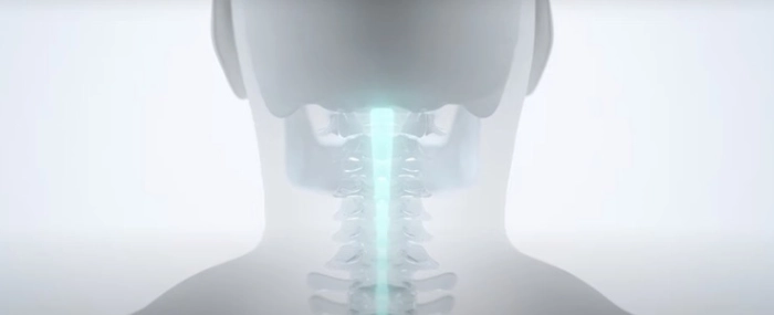 Titlespine